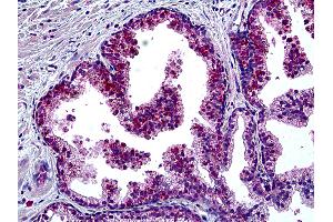 Anti-MSH6 antibody IHC of human prostate. (MSH6 antibody  (AA 2-14))