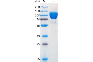 Human N Protein, hFc Tag on SDS-PAGE under reducing condition. (TRKA Protein (AA 33-410) (Fc Tag))