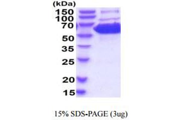 PKM Protein (AA 1-531) (His tag)