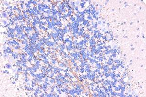 Immunohistochemistry of paraffin-embedded human brain using ARMET/ARP/MANF Rabbit pAb (ABIN6129561, ABIN6143461, ABIN6143463 and ABIN6222775) at dilution of 1:50 (40x lens). (MANF antibody  (AA 25-182))
