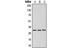 Western blot analysis of CD158g expression in HeLa (A), SP2/0 (B), NIH3T3 (C) whole cell lysates. (KIR2DS5 antibody  (Center))