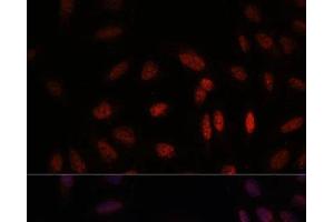 Immunofluorescence analysis of U-2 OS cells using WDR18 Polyclonal Antibody at dilution of 1:100. (WDR18 antibody)