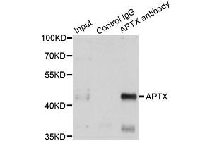 Immunoprecipitation analysis of 150ug extracts of A549 cells using 3ug APTX antibody. (Aprataxin antibody)