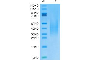 Monkeypox virus A30 on Tris-Bis PAGE under reduced condition. (MPXV A30L (AA 22-146) protein (His tag))