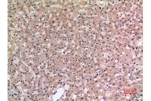 Immunohistochemical analysis of paraffin-embedded human-liver, antibody was diluted at 1:100. (SLC10A1 antibody  (C-Term))