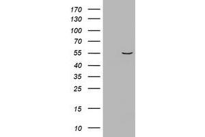 Image no. 1 for anti-Vimentin (VIM) (AA 210-466) antibody (ABIN1491201) (Vimentin antibody  (AA 210-466))