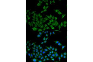Immunofluorescence analysis of HeLa cell using DIDO1 antibody. (DIDO1 antibody)