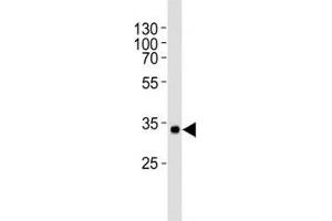 Western blot analysis of human recombinant protein using vWF antibody at 1:1000. (VWF antibody)