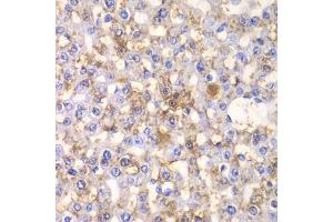 Immunohistochemistry of paraffin-embedded rat liver using H antibody (ABIN6129787, ABIN6141601, ABIN6141603 and ABIN6216048) at dilution of 1:100 (40x lens). (HAPLN1 抗体  (AA 165-354))