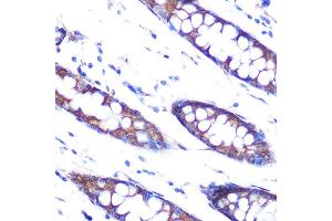 Immunohistochemistry of paraffin-embedded human colon using HSP47/SERPINH1 Rabbit mAb (ABIN7270238) at dilution of 1:100 (40x lens). (SERPINH1 antibody)