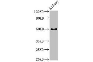 Western Blot Positive WB detected in: Mouse kidney tissue All lanes: PDK1 antibody at 2. (PDPK1 antibody  (AA 294-432))