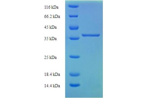 Lysozyme-Like 1 Protein (LYZL1) (AA 1-194) (His-SUMO Tag)