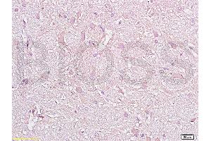 Formalin-fixed and paraffin embedded rat brain tissue with labeled Anti-CD38 Polyclonal Antibody, Unconjugated (ABIN730498) at 1:200, followed by conjugation to the secondary antibody and DAB staining (CD38 antibody  (AA 101-200))