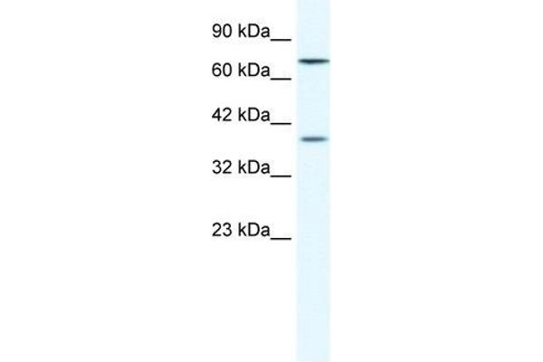 ZNF660 anticorps  (C-Term)