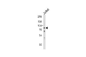 Western blot analysis of lysate from Jurkat cell line,using HSPA6 Antibody . (HSPA6 antibody  (C-Term))