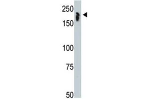 Western Blotting (WB) image for anti-Nuclear Receptor Co-Repressor 1 (NCOR1) antibody (ABIN2996086) (NCOR1 antibody)