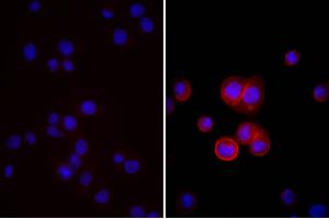 Human pancreatic carcinoma cell line MIA PaCa-2 was stained with Mouse Anti-Human CD44-UNLB, and DAPI. (Donkey anti-Mouse IgG (Heavy & Light Chain) Antibody (HRP) - Preadsorbed)