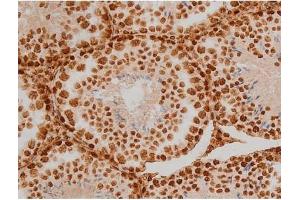 ABIN6267384 at 1/200 staining Mouse testis tissue sections by IHC-P. (Ezrin antibody  (pTyr353))