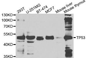 Western blot analysis of extracts of various cell lines, using TP53 antibody. (p53 antibody)