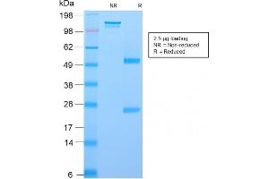 SDS-PAGE (SDS) image for anti-Nerve Growth Factor Receptor (NGFR) (AA 281-421) antibody (ABIN6940191)