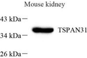 Western blot analysis of TSPAN31 (ABIN7075868) at dilution of 1: 1000,Lane 1: Mouse kidney tissue lysate (TSPAN31 antibody)