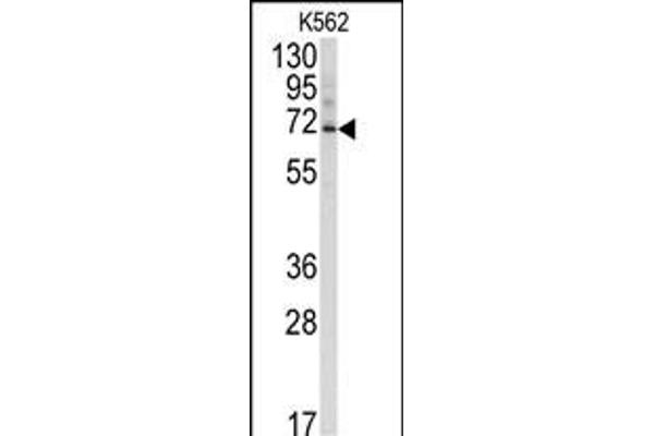 Ubiquilin 3 antibody  (N-Term)