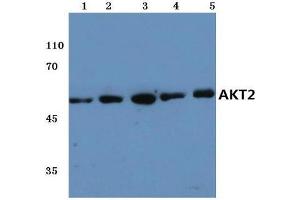 Western Blot analysis of Akt2 antibody at 1/500 dilution. (AKT2 antibody)