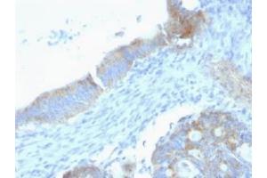 Formalin-fixed, paraffin-embedded human testicular carcinoma stained with anti-Perlecan antibody (SPM255). (HSPG2 antibody)