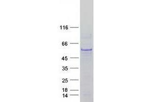 p53 Protein (Transcript Variant 1) (Myc-DYKDDDDK Tag)