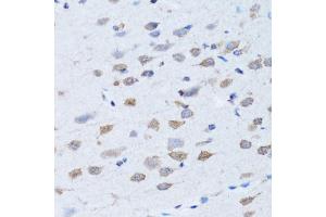 Immunohistochemistry of paraffin-embedded rat brain using LDLRAP1 antibody. (LDLRAP1 antibody)