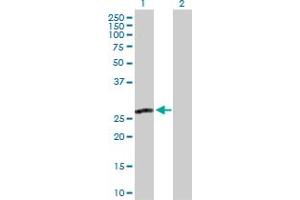 Western Blot analysis of MPZL2 expression in transfected 293T cell line by MPZL2 MaxPab polyclonal antibody. (MPZL2 antibody  (AA 1-215))