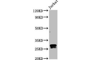 Western Blot Positive WB detected in Jurkat whole cell lysate All lanes CD99 antibody at 0. (Recombinant CD99 antibody)
