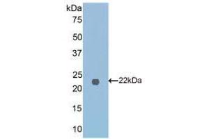 Western blot analysis of recombinant Mouse FTMT. (Ferritin Mitochondrial antibody  (AA 54-229))