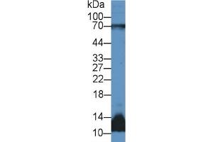 Western Blotting (WB) image for Decorin (DCN) ELISA Kit (ABIN6574301)