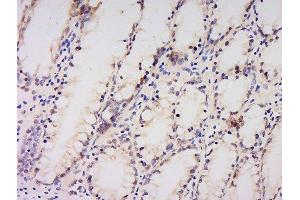Formalin-fixed and paraffin embedded human kidney labeled with Anti-AMPK alpha-1 Polyclonal Antibody, Unconjugated  at 1:200 followed by conjugation to the secondary antibody and DAB staining. (PRKAA1 antibody  (AA 351-450))