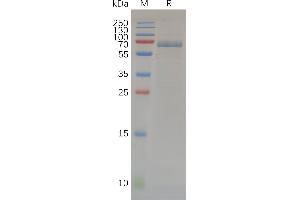 Human Protein, hFc Tag on SDS-PAGE under reducing condition. (MMP14 Protein (AA 112-541) (Fc Tag))