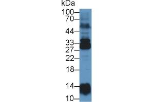 Western Blot; Sample: Human Lung lysate; Primary Ab: 1µg/ml Rabbit Anti-Human NME6 Antibody Second Ab: 0. (Non Metastatic Cells 6, Protein Expressed In (AA 3-182) antibody)