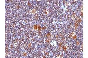 Formalin-fixed, paraffin-embedded human Hodgkin's Lymphoma stained with Bax Monoclonal Antibody (Clone SPM33). (BAX antibody  (AA 3-16))