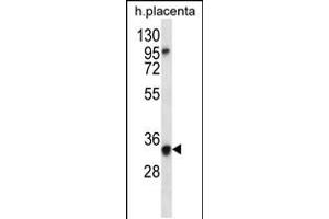 Western blot analysis in human placenta tissue lysates (35ug/lane). (OR6N2 antibody  (C-Term))