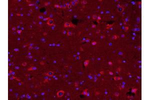 Paraformaldehyde-fixed, paraffin embedded Mouse brain; Antigen retrieval by boiling in sodium citrate buffer (pH6. (TUBB3 antibody  (AA 401-450) (AbBy Fluor® 594))