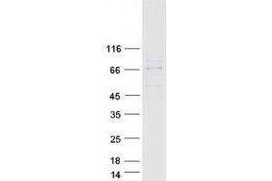 Validation with Western Blot (HDC Protein (Myc-DYKDDDDK Tag))