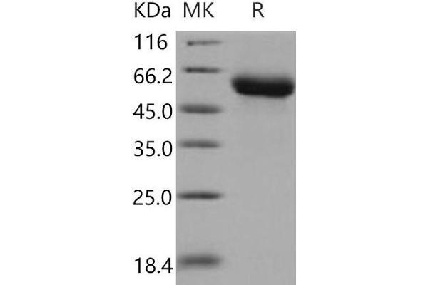 GFRA1 Protein (His tag)