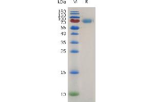 Mouse IL2RA Protein, hFc Tag on SDS-PAGE under reducing condition. (CD25 Protein (AA 22-236) (Fc Tag))