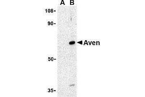 Western Blotting (WB) image for anti-Apoptosis, Caspase Activation Inhibitor (AVEN) (N-Term) antibody (ABIN1031252) (AVEN antibody  (N-Term))