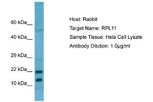 Western Blotting (WB) image for anti-Ribosomal Protein L11 (RPL11) (C-Term) antibody (ABIN971600) (RPL11 antibody  (C-Term))