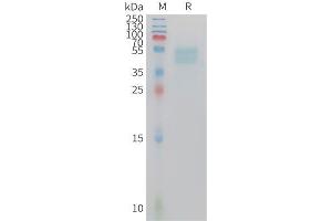 Mouse GIPR Protein, hFc Tag on SDS-PAGE under reducing condition. (GIPR Protein (AA 19-134) (Fc Tag))