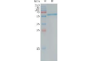 Human ALPP Protein, His Tag on SDS-PAGE under reducing condition. (PLAP Protein (AA 23-505) (His tag))