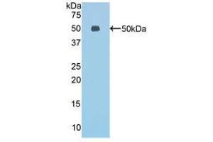 Western blot analysis of recombinant Mouse ESM1. (ESM1 antibody  (AA 22-184))