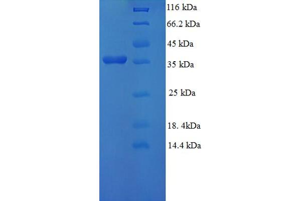 GGCT Protein (AA 1-188, full length) (His-SUMO Tag)