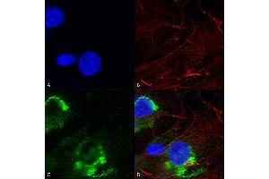 Immunocytochemistry/Immunofluorescence analysis using Mouse Anti-GFAP R416WT Monoclonal Antibody, Clone S206B-9 (ABIN1740967). (GFAP antibody  (AA 411-422) (Atto 594))